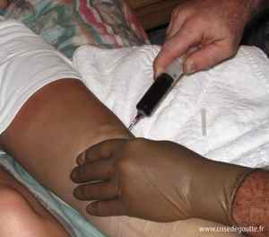 Infiltration genou Infiltration genou